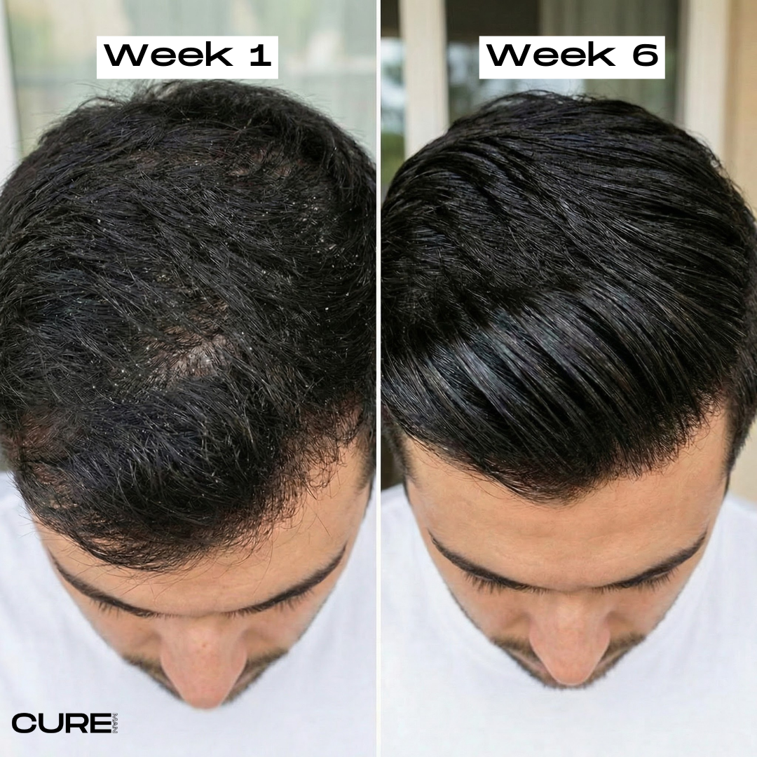 Argan Clay™ 3+2 Gratis